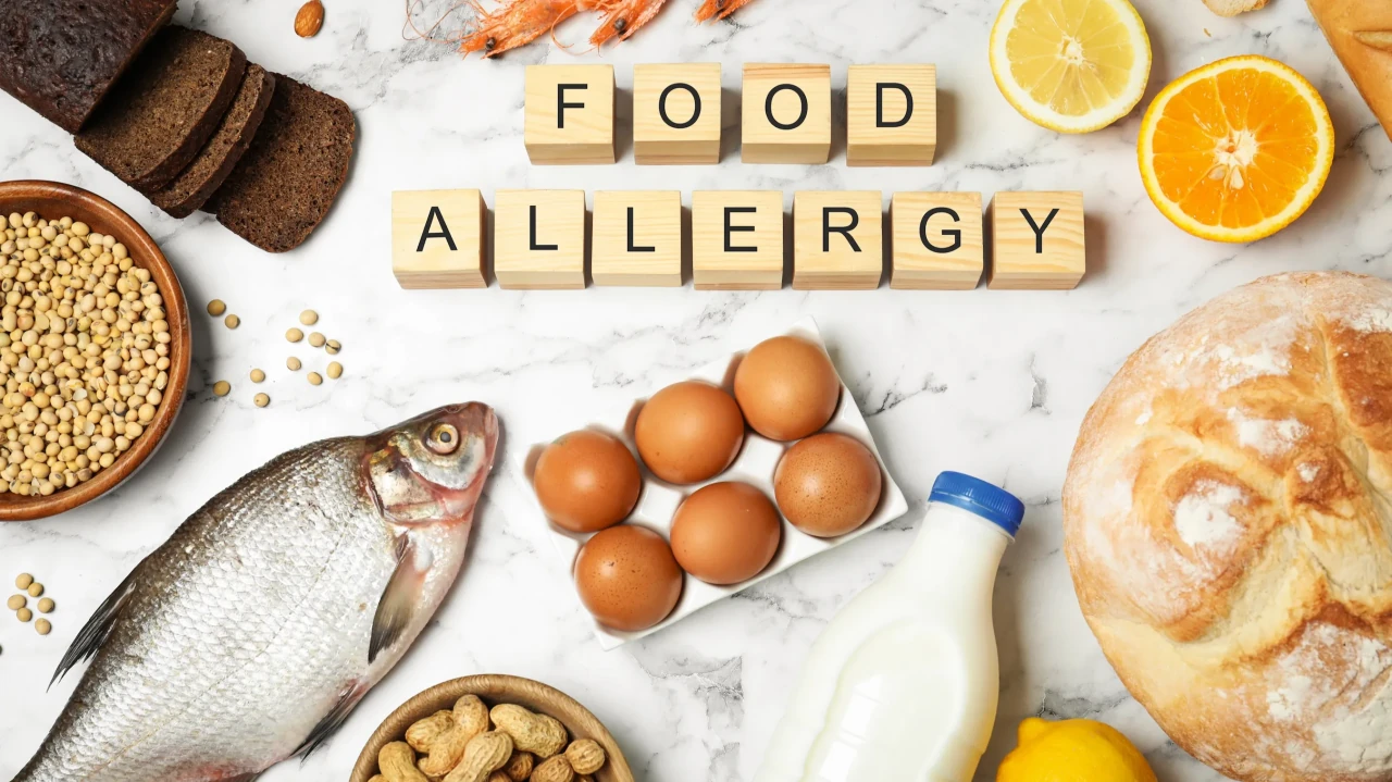 Common foods arranged around letter tiles spelling Food Allergy.